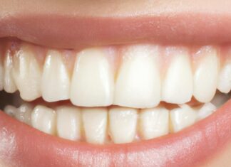 Koliko zubne krunice traju i od čega zavisi njihova trajnost? Pogled na zube osobe koja se osmehuje