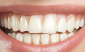 Koliko zubne krunice traju i od čega zavisi njihova trajnost? Pogled na zube osobe koja se osmehuje