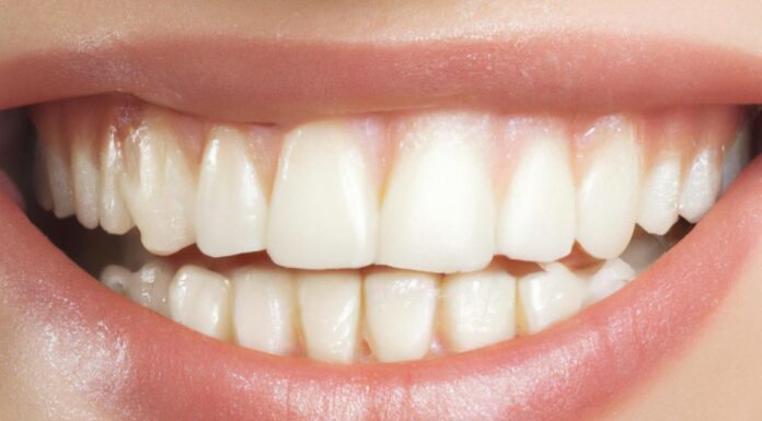 Pogled na zube osobe koja se osmehuje